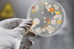 У серпні на лептоспіроз захворіли 2 мешканців Дрогобича
