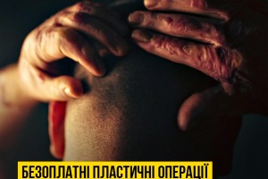 Розпочинається набір пацієнтів з травмами обличчя для участі в четвертій місії FACE TO FACE 2024!